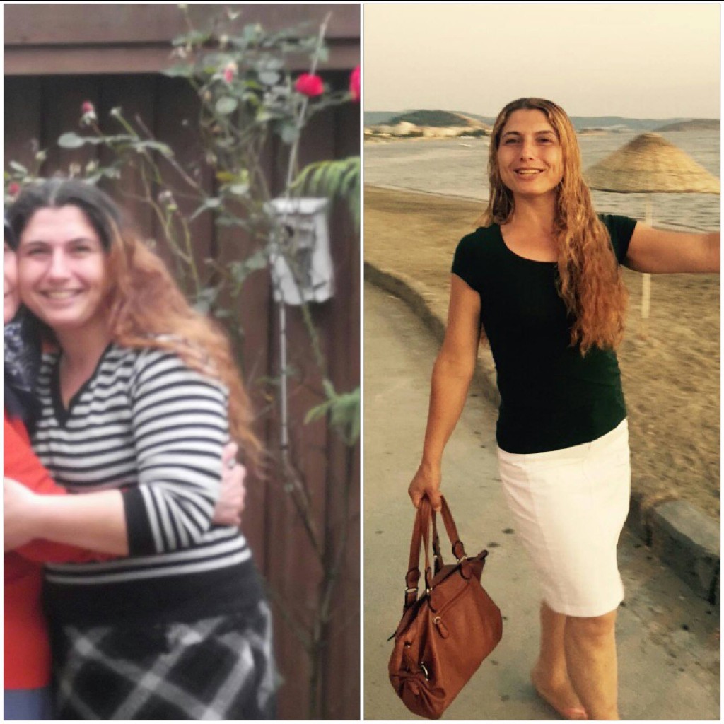 Ayfer before and after (FOOD&YOU)