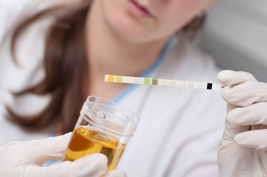 pH-waarde urine meten ontzuren | FOOD&YOU